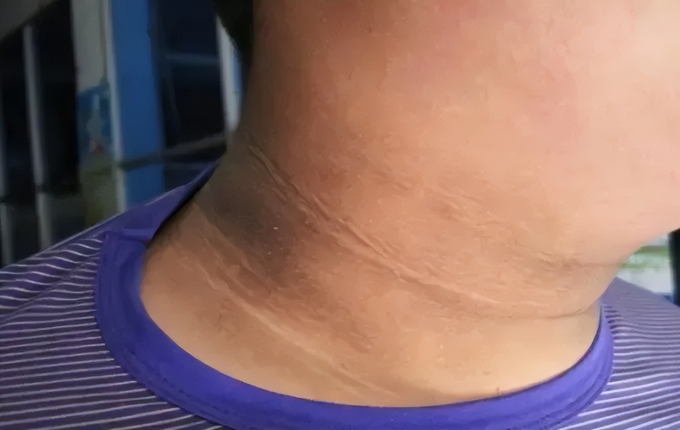 从身体特征看健康：具备这 7 个特点，或拥有 “长寿体质”插图1