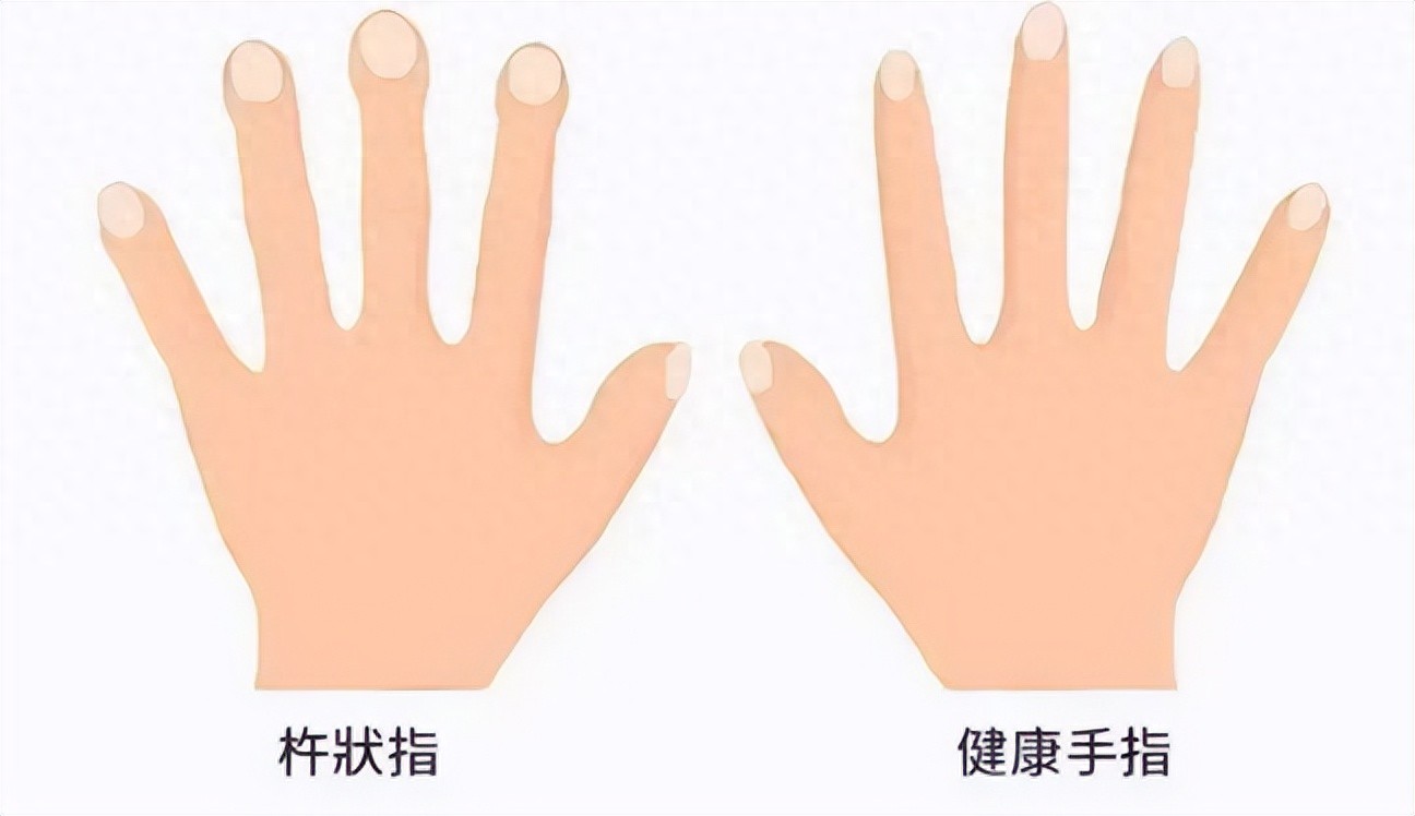 从身体特征看健康：具备这 7 个特点，或拥有 “长寿体质”