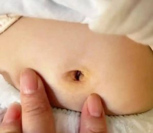 新生儿硬肿症如何防治？科普病症危害、温阳散寒疗法、用药方式与保暖措施