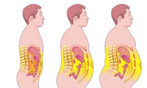 肥胖去医院挂什么科？