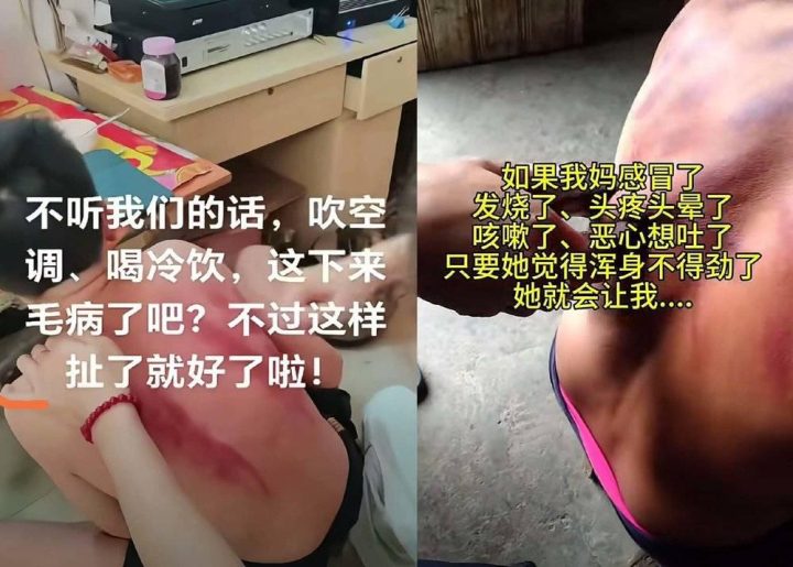 警惕 “宝妈自学中医” 乱象:传统医学在荒诞实践中被扭曲插图7 警惕 “宝妈自学中医” 乱象:传统医学在荒诞实践中被扭曲插图7