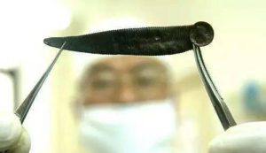 蚂蟥中药属性手册：生态特征、功效作用及主治病症指南插图1