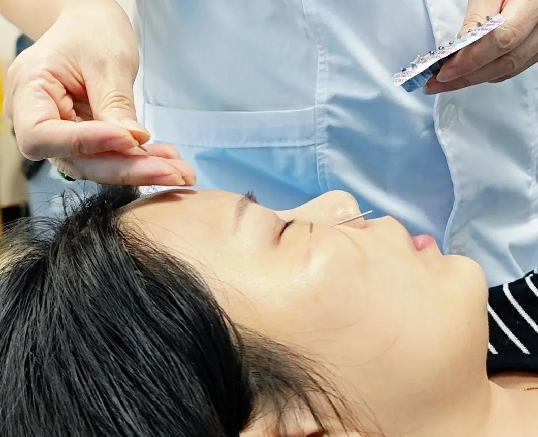 分享 5 个抗衰穴位，“以通为补” 抗衰与医美相比有何优势？插图7