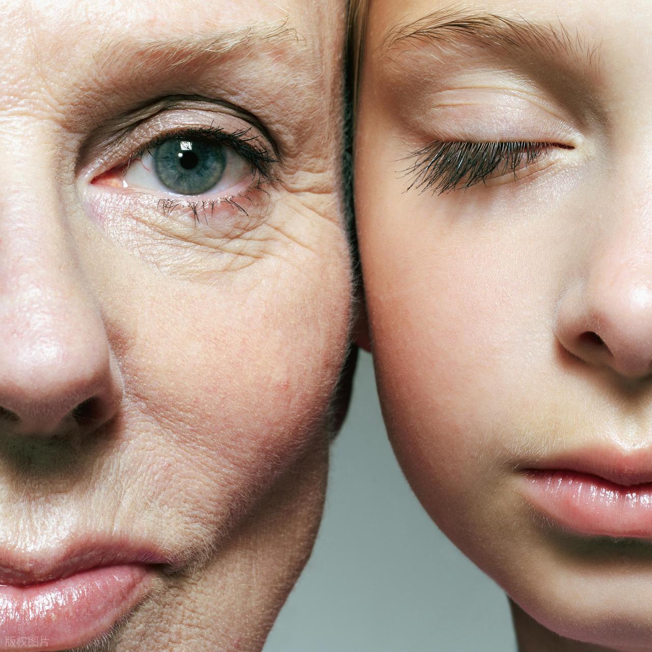 分享 5 个抗衰穴位，“以通为补” 抗衰与医美相比有何优势？插图8