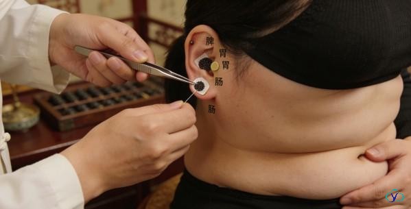 大脑肥大是什么意思？