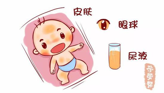 孩子怎么确诊癫？插图1