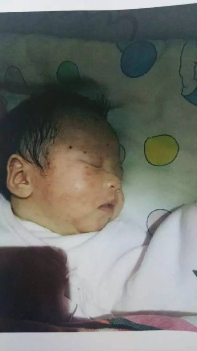 儿童治疗小孩癫？插图1