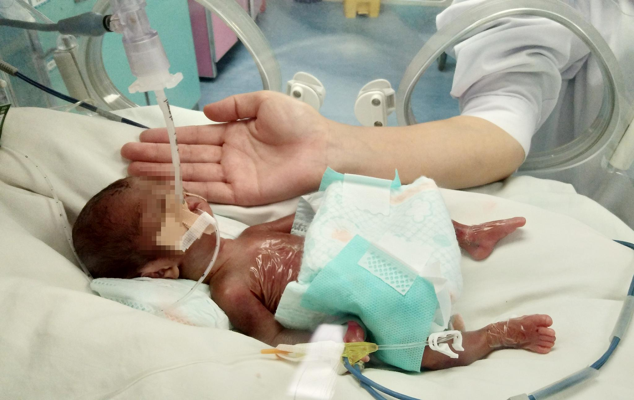 孩子癫怎么急救？插图2