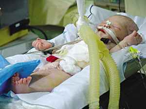 儿童蛲虫病症状？插图1