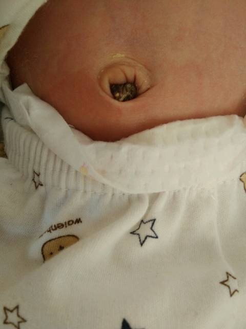 什么是胎怯？一文读懂病症特点、中医辨证方案、常用方剂及孕期预防要点