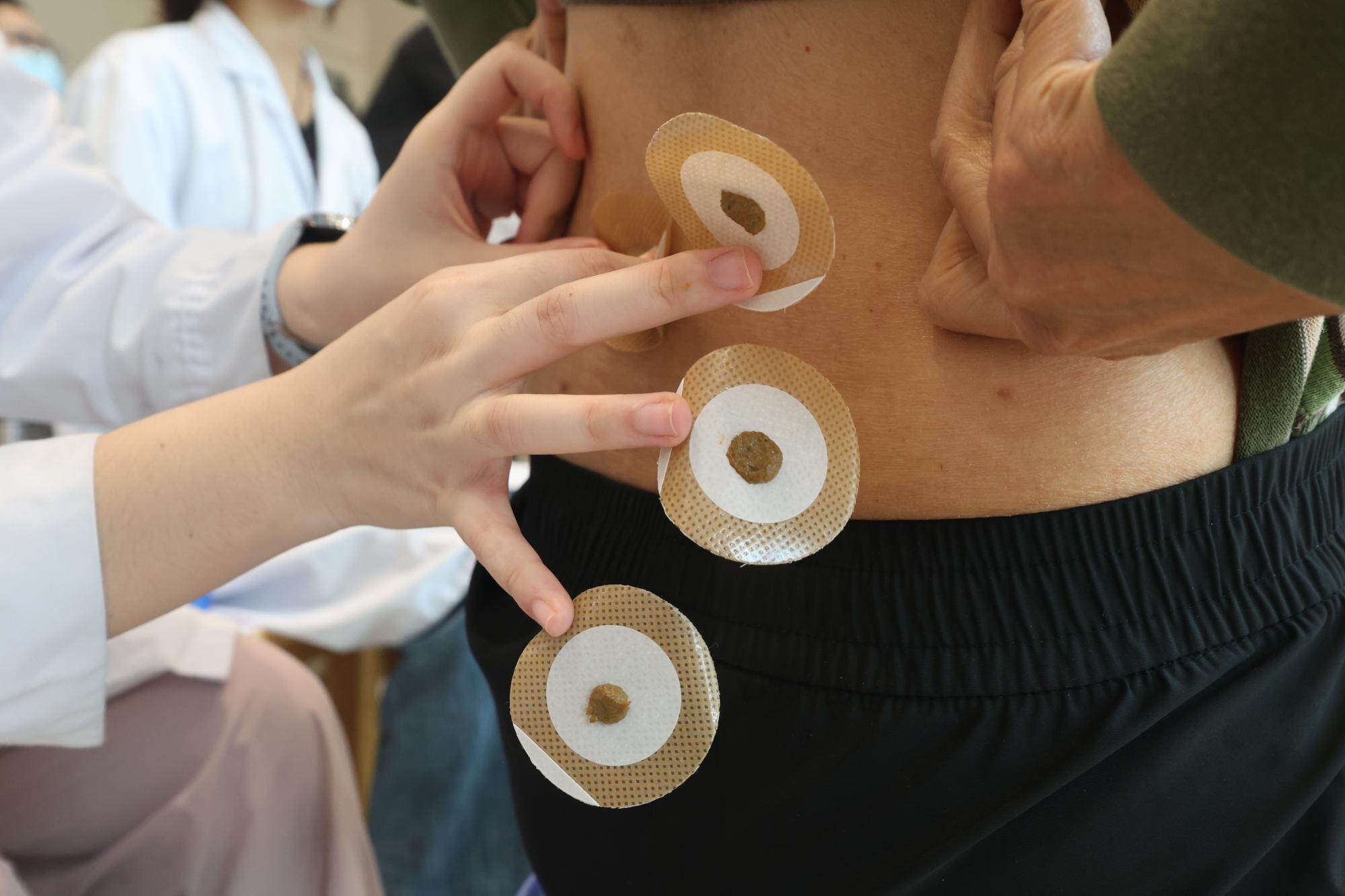 广东三九天养生指南：穴位按摩 + 食疗方 应对 “寒包火”插图1