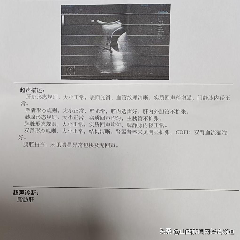 长治市中医医院肿瘤科如何诊断腹腔弥漫大 B 细胞淋巴瘤化疗后复发患者的病情？插图2